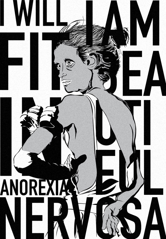 Anorexia Nervosa